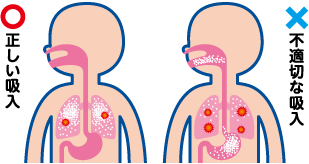 ぜん息の吸入薬は、少ない量でも気道に直接届くことで、十分な効果があらわれます。不適切な吸入では、薬のほとんどが気管支に届かずに体の外へ出てしまったり、口の中に残ってしまいます。