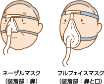 ネーザルマスク（装着部：鼻）とフルフェイスマスク（装着部：鼻と口）