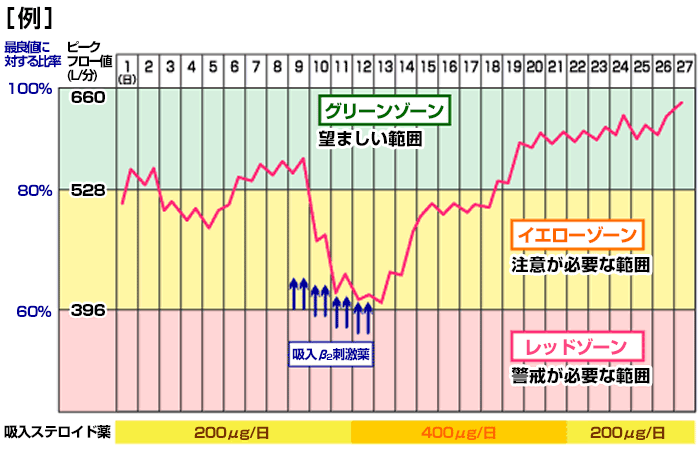 実践編ぜん息をコントロールする