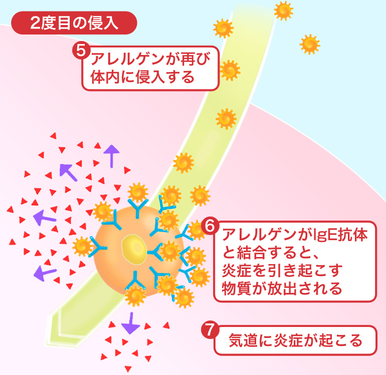 図 アレルゲンの2度目の侵入