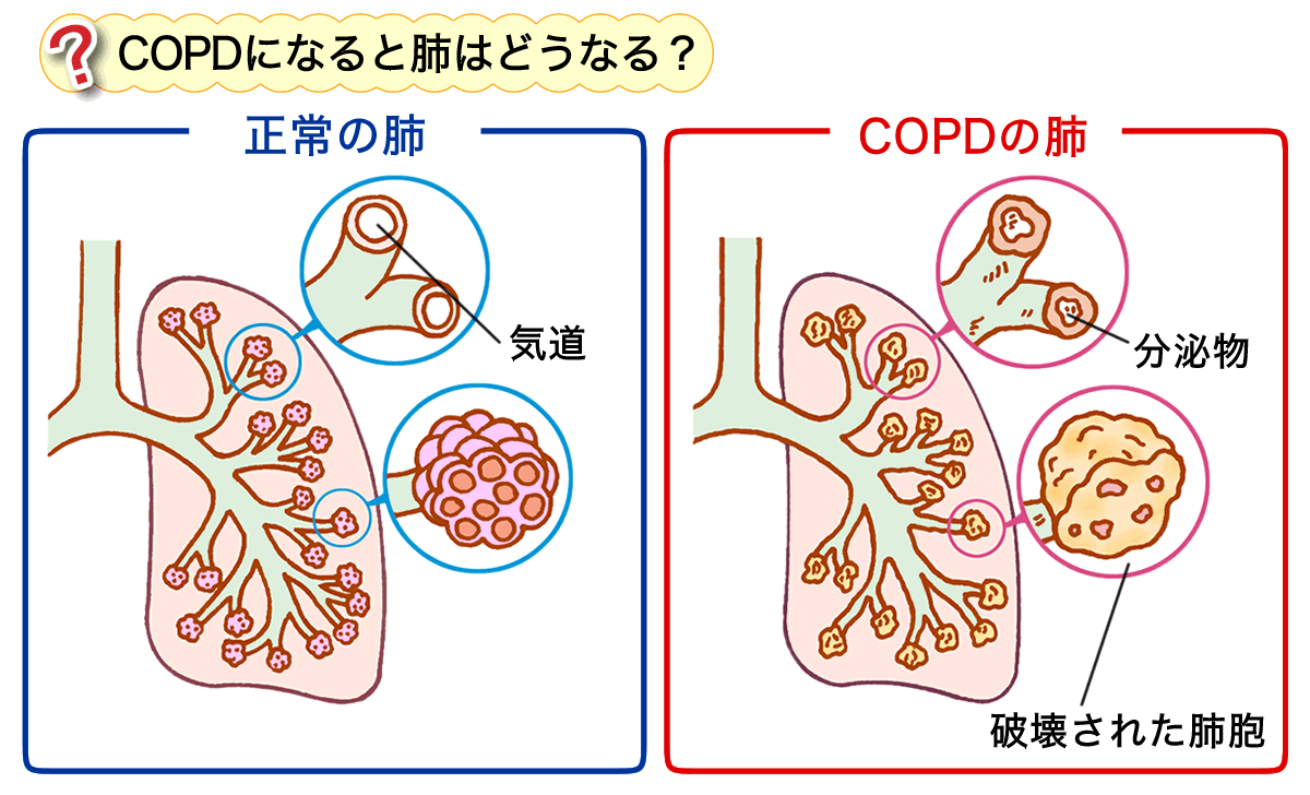 夜中 息苦しい