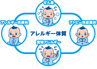 アレルギーの病気（アトピー性皮膚炎、食物アレルギー、アレルギー性鼻炎など）がある子どもは、アレルギー体質をもつことが多く、ぜん息にもなりやすくなります。