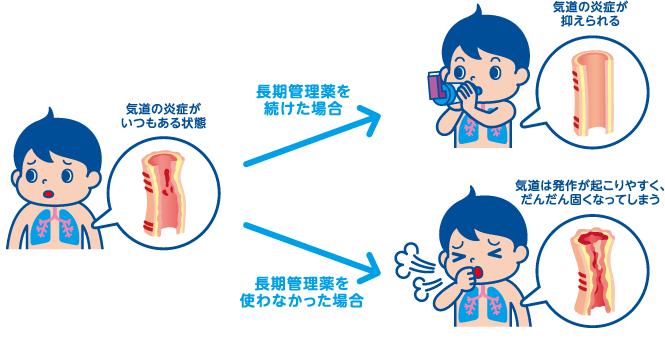 気道の炎症がいつもある状態で長期管理薬を続けた場合は気道の炎症が抑えられます。反対に長期管理薬を使わなかった場合は気道は発作が起こりやすく、だんだん固くなってしまいます。