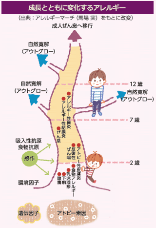 アレルギー マーチ を進行させないために 特集 43号 Web版すこやかライフ ぜん息などの情報館 大気環境 ぜん息などの情報館 独立行政法人環境再生保全機構