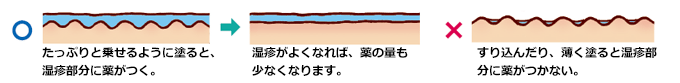 ○たっぷりと乗せるように塗ると、湿疹部分に薬がつく。→湿疹がよくなれば、薬の量も少なくなります。×すり込んだり、薄く塗ると湿疹部分に薬がつかない。