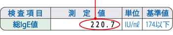 検査結果には検査測定値とともに基準値が記載されていますので、比較してみてください。