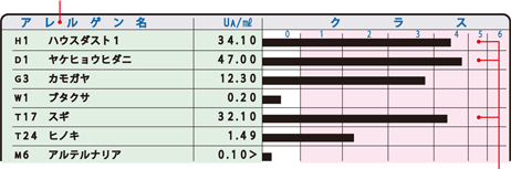 検査結果にはアレルゲン別の抗原特異的IgE抗体値とクラスレベルが記載されています。ここには、ハウスダストとヤケヒョウヒダニとスギ花粉に対する特異的IgE抗体値がクラス4を示す検査結果例をあげています。