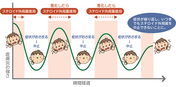 顔 方 副作用 ステロイド 治し