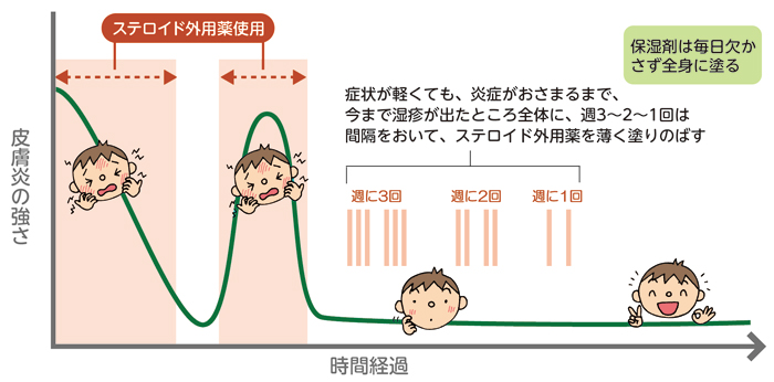 保湿剤は毎日欠かさず全身に塗り、ステロイド外用薬は、症状が軽くても、炎症がおさまるまで、はじめ週3回、段階的に週2回、そして週1回と間隔をおいて回数を減らして、今まで湿疹が出たところ全体に、薄く塗りのばす療法。