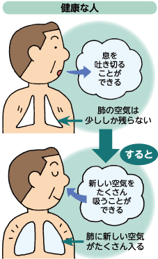 健康な人は息を吐き切ることができるので、肺の空気は少ししか残らない。すると、新しい空気をたくさん吸うことができ、肺に新しい空気がたくさん入る