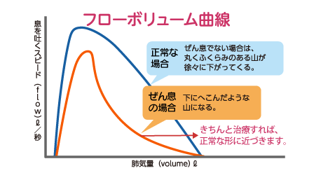 正常な場合の曲線は、息を吐くスピートが長く肺気量も徐々に減らしていくことができるので、丸いふくらみのある山が徐々に下がってきます。一方、ぜん息の場合の曲線は、息を吐くスピードが短く肺気量も急激に減るので、下にへこんだような山になります。きちんと治療すれば、正常な形に近づきます。