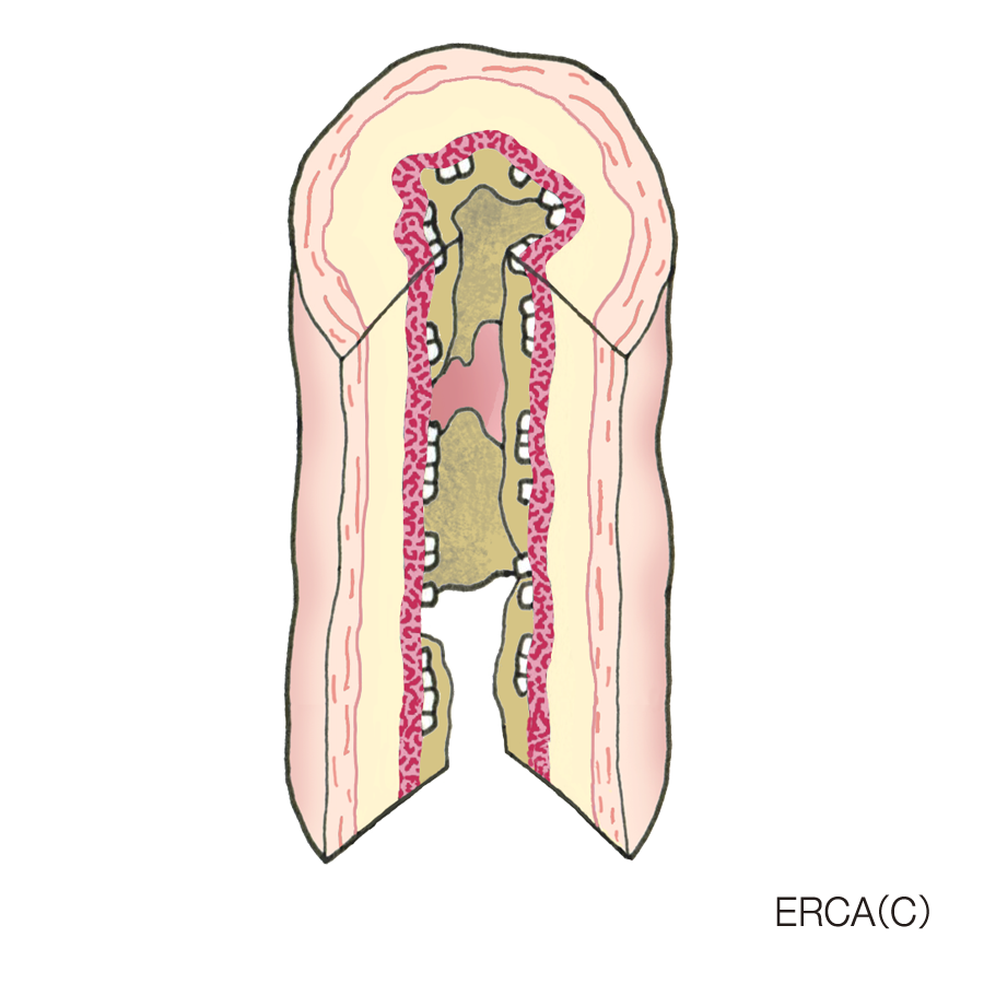 イラストダウンロード パンフレット 大気環境 ぜん息などの情報館 大気環境 ぜん息などの情報館 独立行政法人環境再生保全機構