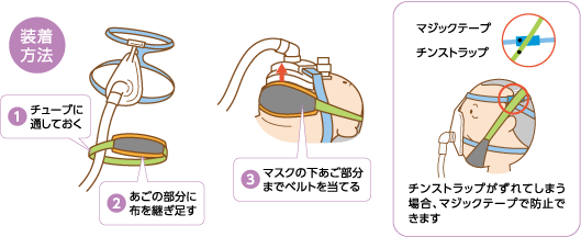 チンストラップを利用する