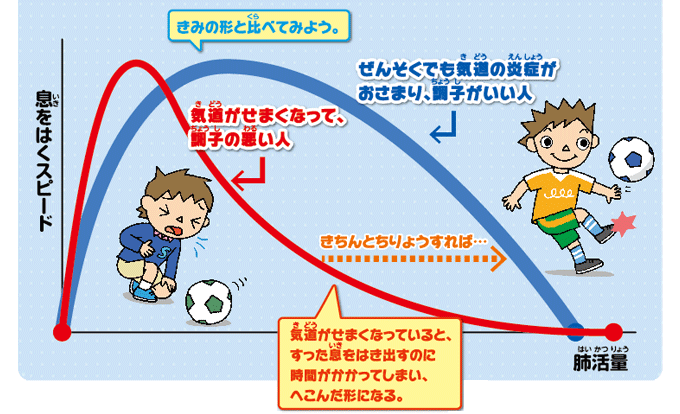 きみの形と比べてみよう　ぜんそくでも気道の炎症がおさまり、調子がいい人　気道がせまくなって、調子の悪い人　きちんとちりょうすれば・・・　気道がせまくなっていると、すった息をはき出すのに時間がかかってしまい、へこんだ形になる。