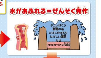 水があふれる＝ぜんそく発作