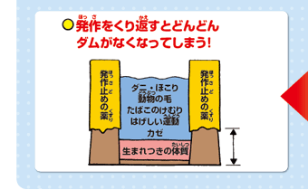 発作をくり返すとどんどんダムがなくなってしまう！