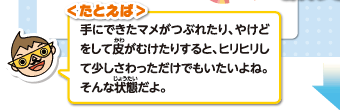 たとえば手にできたマメがつぶれたり、やけどをして皮がむけたりすると、ヒリヒリして少しさわっただけでもいたいよね。そんな状態だよ。