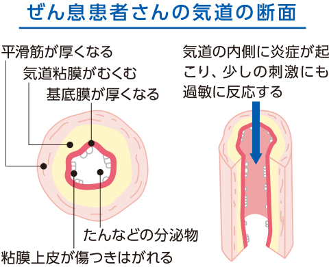 普段の気道の断面