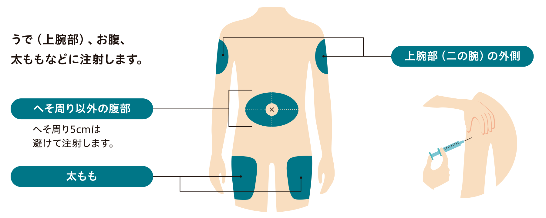 皮下注射の場所